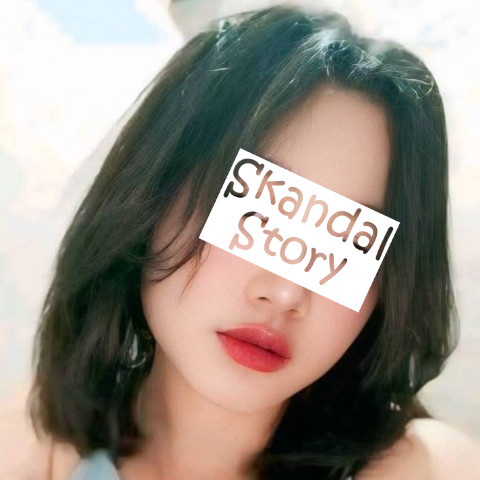 Skandal Story