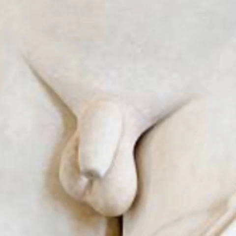 Achilles_Shawn