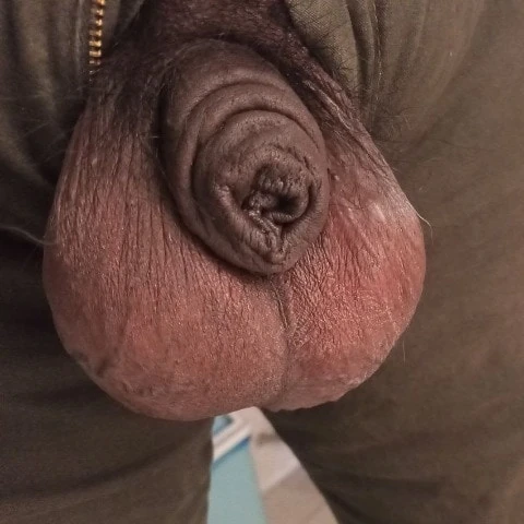 Toxxxido
