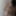 ZIAxBITE