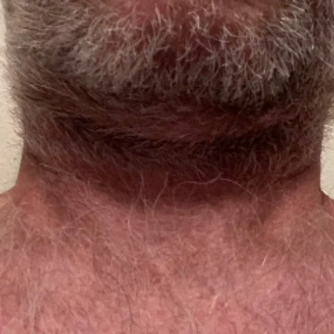 ButNakedone