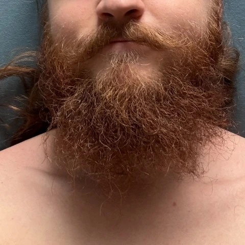 Bearded Fox