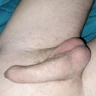 Ejacprostate