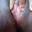 Glaucorrea